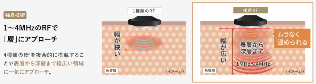 ディープリフトはRF(ラジオ波)による温熱ケアが中心